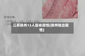 江苏徐州13人复核阳性(徐州检出阳性)