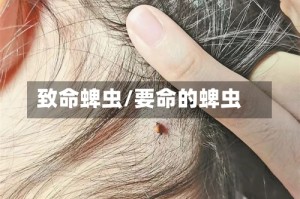 致命蜱虫/要命的蜱虫