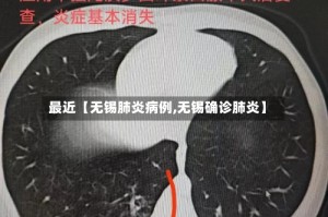 最近【无锡肺炎病例,无锡确诊肺炎】