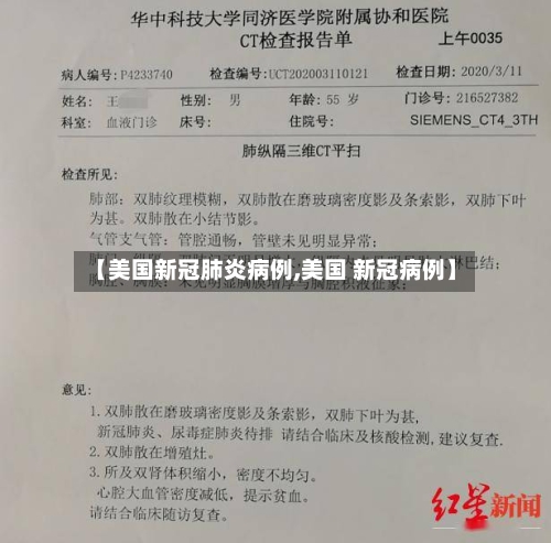 【美国新冠肺炎病例,美国 新冠病例】-第3张图片