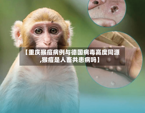 【重庆猴痘病例与德国病毒高度同源,猴痘是人畜共患病吗】-第1张图片